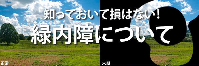 緑内障 エアフライ 見え方